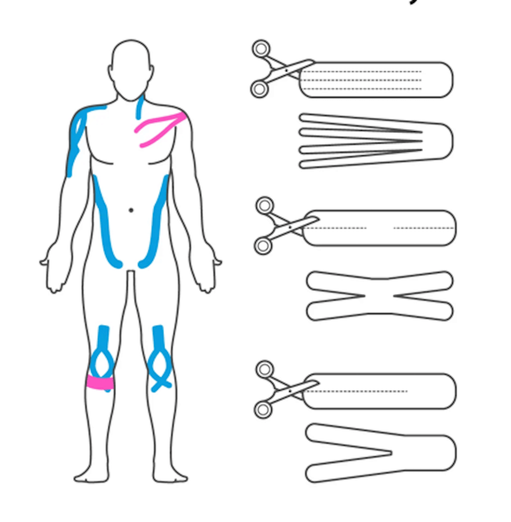 Why do Professionals Use Kinesiology Tape?