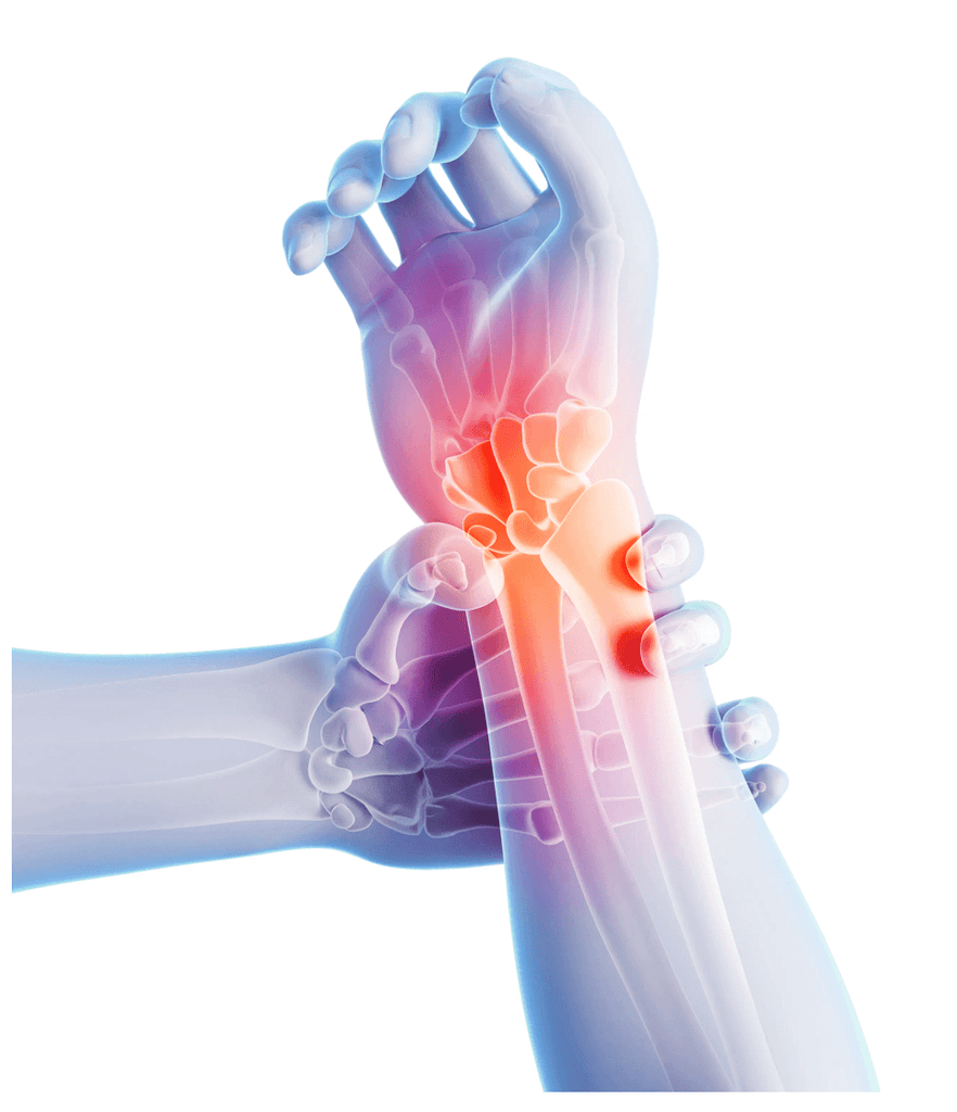 The Kinesiology Tape Glove